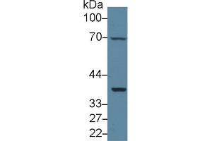 Western Blot; Sample: Mouse Liver lysate; Primary Ab: 1µg/ml Rabbit Anti-Human gp130 Antibody Second Ab: 0. (CD130/gp130 Antikörper  (AA 606-756))