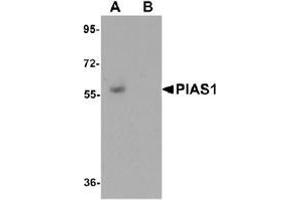 Western blot analysis of PIAS1 in human kidney tissue lysate with PIAS1 antibody at 1 μg/ml in (A) the absence and (B) the presence of blocking peptide. (PIAS1 Antikörper  (C-Term))