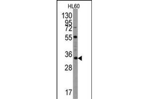 Western blot analysis of UBTD1 Antibody (C-term ) (ABIN387937 and ABIN2844471) in Hl60 cell line lysates (35 μg/lane). (UBTD1 Antikörper  (C-Term))