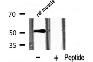 Western blot analysis of p53 phosphorylation expression in rat muscle lysates,The lane on the right is treated with the antigen-specific peptide. (p53 Antikörper  (pSer20))