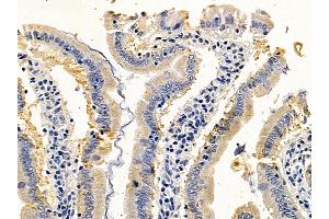 ABIN6259596 and ABIN6275561 at 1/100 staining rat colorectal tissue by IHC-P.