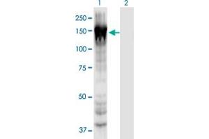 Western Blot analysis of MYO1E expression in transfected 293T cell line by MYO1E monoclonal antibody (M02), clone 7A5. (MYO1E Antikörper  (AA 918-1014))