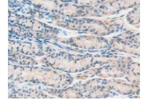 IHC-P analysis of Mouse Intestine Tissue, with DAB staining. (PTPRJ Antikörper  (AA 567-842))