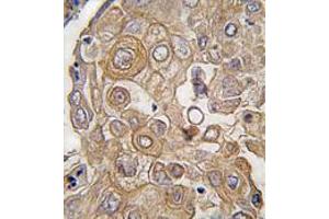 Image no. 3 for anti-Toll-Like Receptor 6 (TLR6) (C-Term) antibody (ABIN357053) (TLR6 Antikörper  (C-Term))