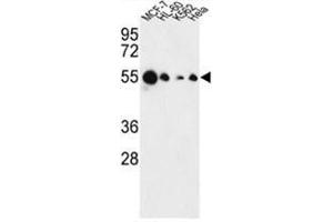 Western blot analysis of AIM2 Antibody (N-term) in MCF-7, HL-60, K562, Hela cell line lysates (35 µg/lane). (AIM2 Antikörper  (N-Term))