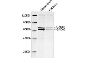 Western blot analysis of tissue lysates using 1 µg/mL Rabbit Anti-GAD65+GAD67 Polyclonal Antibody (ABIN398919) The signal was developed with IRDyeTM 800 Conjugated Goat Anti-Rabbit IgG. (GAD65+GAD67 (AA 550-600) Antikörper)