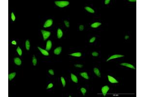 Immunofluorescence of purified MaxPab antibody to HDAC2 on HeLa cell.