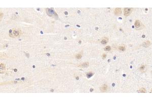 Immunohistochemistry (IHC) image for anti-Leptin (LEP) (AA 22-167) antibody (ABIN7445093)