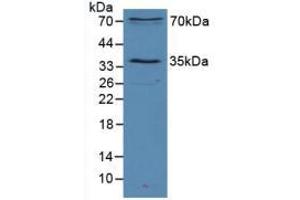Figure. (SIRT2 Antikörper  (AA 65-340))