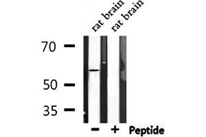 Western blot analysis of extracts from rat brain, using Phospho-ATF2 (Ser62/44) Antibody. (ATF2 Antikörper  (pSer44, pSer62))