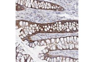 Immunohistochemical staining of human rectum with ARHGAP44 polyclonal antibody  shows strong cytoplasmic positivity in glandular cells.