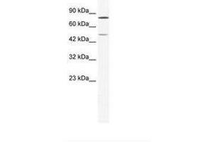 Image no. 1 for anti-Zinc Finger Protein 12 (ZNF12) (AA 165-214) antibody (ABIN202872)