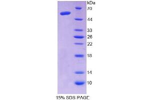 SDS-PAGE analysis of Human AASS Protein. (AASS Protein)