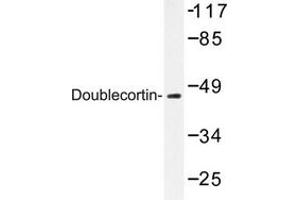 Image no. 2 for anti-Doublecortin (DCX) antibody (ABIN272098) (Doublecortin Antikörper)