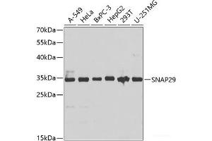 Western blot analysis of extracts of various cell lines using SNAP29 Polyclonal Antibody at dilution of 1:1000. (SNAP29 Antikörper)