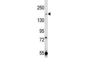 TRPM7 antibody western blot analysis in 293 lysate (TRPM7 Antikörper  (AA 1821-1850))