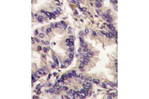Immunohistochemistry (IHC) image for anti-Vascular Endothelial Growth Factor C (VEGFC) antibody (ABIN3001426) (VEGFC Antikörper)