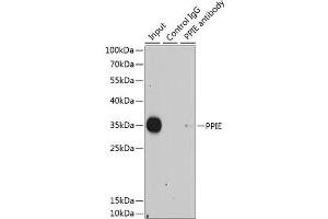 Immunoprecipitation analysis of 200 μg extracts of HeLa cells using 1 μg PPIE antibody . (PPIE Antikörper  (AA 1-301))