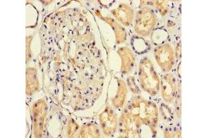 Immunohistochemistry of paraffin-embedded human kidney tissue using ABIN7161762 at dilution of 1:100 (NFIX Antikörper  (AA 201-440))
