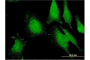Immunofluorescence of monoclonal antibody to FIBP on HeLa cell. (FIBP Antikörper  (AA 1-357))
