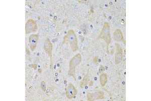 Immunohistochemistry of paraffin-embedded mouse brain using EPHA2 Antibody (ABIN2562444) at dilution of 1:100 (40x lens).