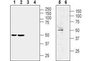 Western blot analysis of rat brain membrane (lane 1 and 3), mouse brain membrane (lanes 2 and 4) and human brain glioblastoma U87 MG cell line (lanes 5 and 6) lysate:  - 1,2,5. (LPAR1 Antikörper  (Extracellular, N-Term))