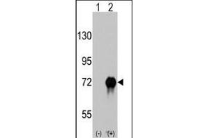 Western blot analysis of RAF1 (arrow) using rabbit polyclonal RAF1 Antibody  (ABIN6243077 and ABIN6579013). (RAF1 Antikörper  (AA 599-628))