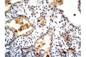 Formalin-fixed and paraffin embedded rat breast tissue labeled with Anti-Phospho-Estrogen Receptor alpha (Ser104/106) Polyclonal Antibody, Unconjugated  at 1:200 followed by conjugation to the secondary antibody and DAB staining