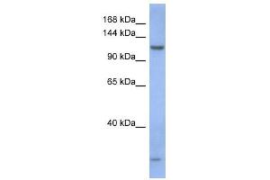 PIWIL1 antibody used at 1 ug/ml to detect target protein. (PIWIL1 Antikörper)