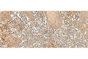 Immunohistochemistry of paraffin-embedded Human tonsil tissue using WLS Polyclonal Antibody at dilution of 1:50(x200) (GPR177/WLS Antikörper)