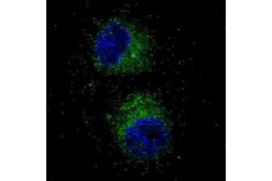 Immunofluorescence (IF) image for anti-Met Proto-Oncogene (MET) antibody (ABIN2995276) (c-MET Antikörper)