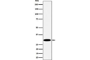 Western blot analysis of TPMT expression in Jurkat cell lysate.