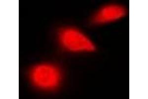Immunofluorescent analysis of p53 staining in HeLa cells. (p53 Antikörper  (C-Term))