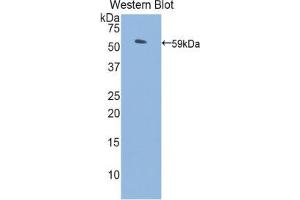 Western blot analysis of the recombinant protein. (PROS1 Antikörper  (AA 261-496))