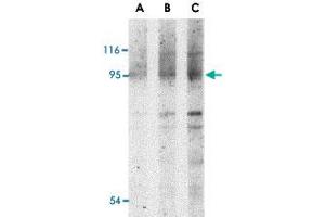 Western blot analysis of NOD2 in Jurkat cell lysate with NOD2 polyclonal antibody  at (A) 1, (B) 2 and (C) 4 ug/mL . (NOD2 Antikörper  (N-Term))