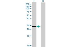 Western Blot analysis of CLEC2B expression in transfected 293T cell line by CLEC2B MaxPab polyclonal antibody. (CLEC2B Antikörper  (AA 1-149))