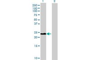 Western Blot analysis of CLEC2B expression in transfected 293T cell line by CLEC2B MaxPab polyclonal antibody.