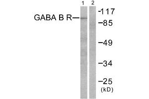 Western Blotting (WB) image for anti-GABA B Receptor (C-Term) antibody (ABIN1848554) (GABA B Receptor (C-Term) Antikörper)