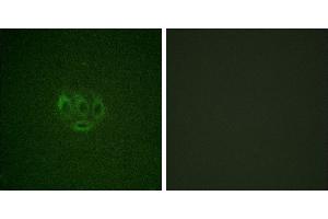 Immunofluorescence analysis of A549 cells, using ACK1 (Phospho-Tyr284) antibody. (TNK2 Antikörper  (pTyr284))