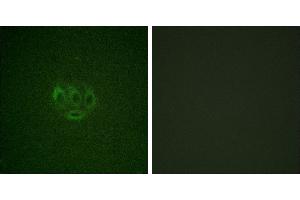 Immunofluorescence analysis of A549 cells, using ACK1 (Phospho-Tyr284) antibody. (TNK2 Antikörper  (pTyr284))