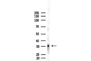 Western blot analysis of lysates from F10-LUC cells(LPS, 4h treatment), using OR4 Antibody at 1/1000 dilution.