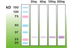Western Blotting (WB) image for anti-Trysin (N-Term) antibody (ABIN870337) (Trysin (N-Term) Antikörper)