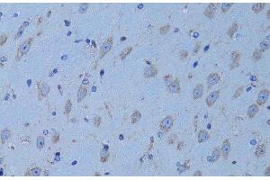 Immunohistochemistry of paraffin-embedded Mouse brain using HADH Polyclonal Antibody at dilution of 1:100 (40x lens). (HADH Antikörper)