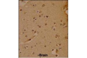 Formalin-fixed and paraffin-embedded human brain reacted with SOX4 Antibody (N-term), which was peroxidase-conjugated to the secondary antibody, followed by DAB staining. (SOX4 Antikörper  (N-Term))
