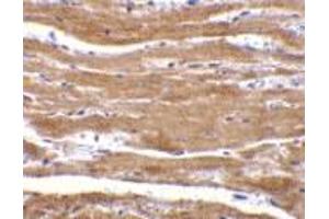 Immunohistochemistry of BACE2 in mouse heart with BACE2 antibody at 10 μg/ml. (BACE2 Antikörper  (N-Term))