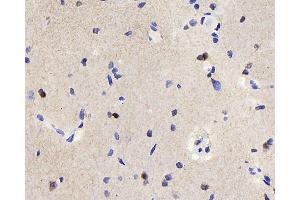 Immunohistochemistry analysis of paraffin-embedded rat brain using TSC22D3 Polyclonal Antibody at dilution of 1:300. (TSC22D3 Antikörper)