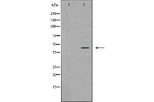 Western blot analysis of MCF-7  lysate using ATXN3 antibody. (Ataxin 3 Antikörper  (Internal Region))