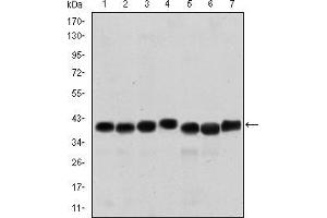 Western blot analysis using SMN1 mouse mAb against HepG2 (1), Hela (2), K562 (3), Jurkat (4), SKBR-3 (5), A431 (6) and Cos7 (7) cell lysate. (SMN1 Antikörper)