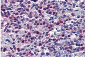 Human Spleen (formalin-fixed, paraffin-embedded) stained with CASP7 antibody ABIN462357 followed by biotinylated anti-mouse IgG secondary antibody ABIN481714, alkaline phosphatase-streptavidin and chromogen. (Caspase 7 Antikörper)