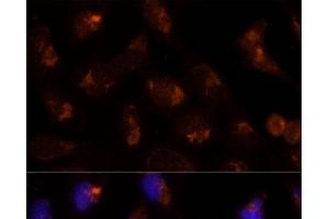Immunofluorescence analysis of U-2 OS cells using SEC14L2 Polyclonal Antibody at dilution of 1:100 (40x lens). (SEC14L2 Antikörper)